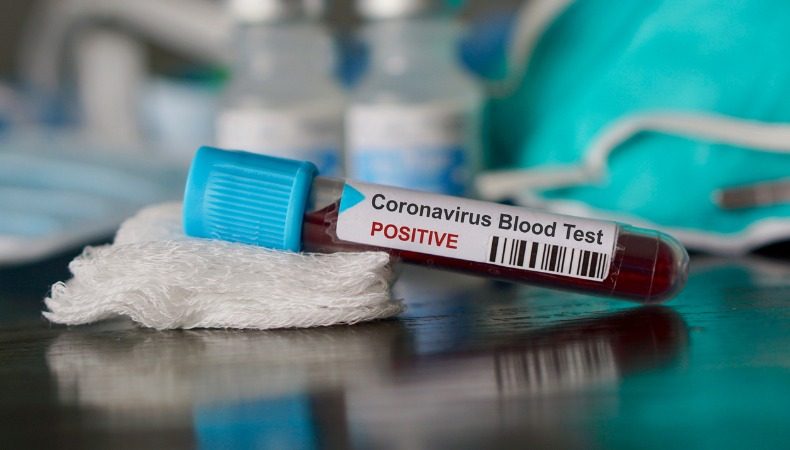 COVID-19 Coronavirus Pandemie